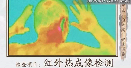 醫(yī)用紅外熱像儀和普通紅外熱像儀有什么區(qū)別
